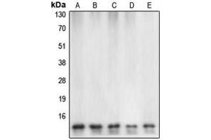 Western blot analysis of Caspase 7 expression in HeLa (A), mouse heart (B), rat heart (C), Jurkat etoposid-treated (D), HEK293T (E) whole cell lysates.
