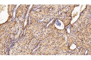Detection of PIIINP in Human Kidney Tissue using Monoclonal Antibody to Procollagen III N-Terminal Propeptide (PIIINP) (PIIINP 抗体)