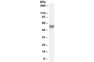 Western blot testing of human bone marrow lysate with CACNB4 antibody at 0. (CACNB4 抗体)