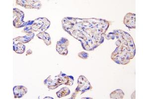 IHC analysis of TJP1 using anti-TJP1 antibody (ABIN7599787). (TJP1 抗体  (AA 1178-1527))