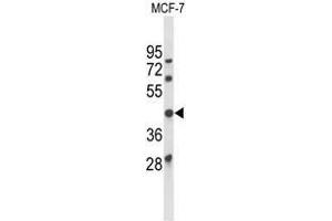 Western blot analysis of ATXN3 Antibody (Center) in MCF-7 cell line lysates (35µg/lane). (Ataxin 3 抗体  (Middle Region))