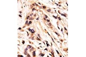 Image no. 2 for anti-Retinoblastoma 1 (RB1) (pSer608) antibody (ABIN358211) (Retinoblastoma 1 抗体  (pSer608))