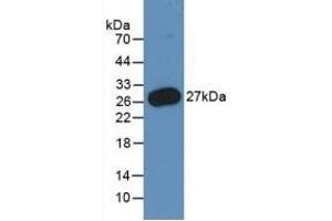 Detection of Recombinant PMP22, Human using Monoclonal Antibody to Peripheral Myelin Protein 22 (PMP22) (PMP22 抗体  (AA 31-133))