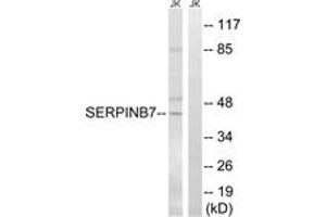Western Blotting (WB) image for anti-serpin Peptidase Inhibitor, Clade B (Ovalbumin), Member 7 (SERPINB7) (AA 111-160) antibody (ABIN2890627) (SERPINB7 抗体  (AA 111-160))