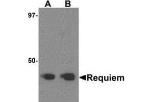 Western blot analysis of Requiem in mouse kidney tissue lysate with Requiem antibody at 1 μg/ml. (DPF2 抗体  (C-Term))