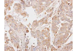 Immunohistochemistry (IHC) image for anti-phosphoenolpyruvate Carboxykinase 2 (Mitochondrial) (PEPCK) antibody (ABIN2855891)