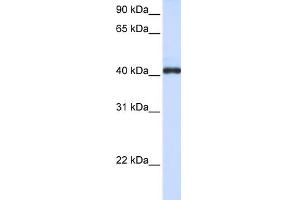 WB Suggested Anti-FCRLA Antibody Titration:  0. (FCRLA 抗体  (C-Term))