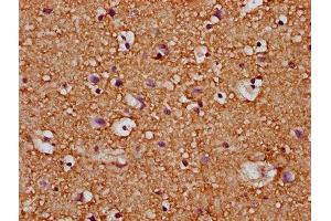 IHC image of ABIN7167153 diluted at 1:200 and staining in paraffin-embedded human brain tissue performed on a Leica BondTM system. (RASAL2 抗体  (AA 749-835))