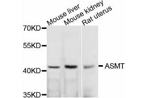 Western blot analysis of extracts of various cell lines, using ASMT antibody (ABIN5999240) at 1/1000 dilution. (ASMT 抗体)
