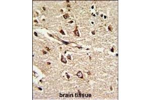Immunohistochemistry (Paraffin-embedded Sections) (IHC (p)) image for anti-Protein Disulfide Isomerase Family A, Member 6 (PDIA6) (AA 144-172) antibody (ABIN390608)
