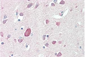 Immunohistochemistry (IHC) image for anti-Prostaglandin D2 Synthase (PTGDS) (Internal Region) antibody (ABIN5539880)