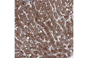 Immunohistochemical staining of human liver with VPS37D polyclonal antibody  shows strong cytoplasmic positivity in hepatocytes. (VPS37D 抗体)