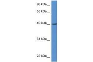 Image no. 1 for anti-Zinc Finger, DHHC-Type Containing 11 (ZDHHC11) (AA 100-149) antibody (ABIN6747230) (ZDHHC11 抗体  (AA 100-149))