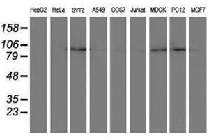 Image no. 3 for anti-Dipeptidyl-Peptidase 8 (DPP8) antibody (ABIN1497835) (DPP8 抗体)