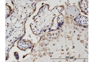 Immunoperoxidase of monoclonal antibody to SIK1 on formalin-fixed paraffin-embedded human placenta. (SIK1 抗体  (AA 1-100))