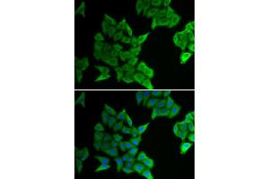 Immunofluorescence analysis of HeLa cells using GJA5 antibody. (Cx40/GJA5 抗体)