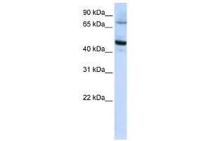 WB Suggested Anti-CYP46A1 Antibody Titration:  0.