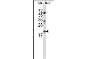 LIN52 Antibody (N-term ) (ABIN657405 and ABIN2846445) western blot analysis in SK-BR-3 cell line lysates (35 μg/lane). (LIN52 抗体  (N-Term))