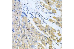 Immunohistochemistry of paraffin-embedded mouse stomach using CASP9 antibody (ABIN5997370) at dilution of 1/100 (40x lens). (Caspase 9 抗体)