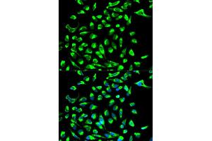 Immunofluorescence analysis of MCF-7 cell using CLDN7 antibody. (Claudin 7 抗体  (AA 29-211))