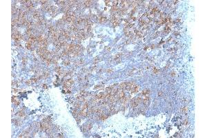 Immunohistochemistry (IHC) image for anti-Ribosomal Protein SA (RPSA) antibody (ABIN6939957)