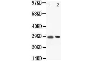 Anti-BOB1 antibody, Western blotting Lane: Rat Spleen Tissue Lysate (POU2AF1 抗体  (C-Term))