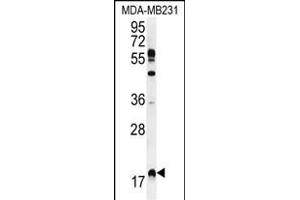 RHEB Antibody (C-term) (ABIN655712 and ABIN2845163) western blot analysis in MDA-M cell line lysates (35 μg/lane). (RHEB 抗体  (C-Term))