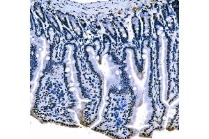 IHC analysis of splicing factor 1 using anti-splicing factor 1 antibody (ABIN7600194).