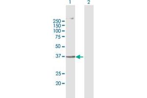 Western Blot analysis of AGPAT5 expression in transfected 293T cell line by AGPAT5 MaxPab polyclonal antibody. (AGPAT5 抗体  (AA 1-364))