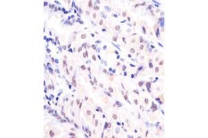 (ABIN6242774 and ABIN6577127) staining EX1 in human stomach sections by Immunohistochemistry (IHC-P - paraformaldehyde-fixed, paraffin-embedded sections). (APEX1 抗体)