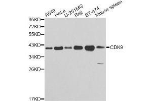 Western blot analysis of extracts of various cell lines, using CDK9 antibody (ABIN5970745) at 1/1000 dilution. (CDK9 抗体)