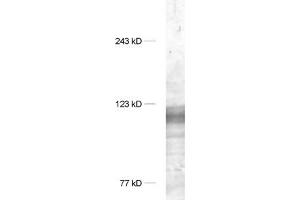 dilution 1 : 1000, sample: synaptic membrane fraction of rat brain (LP1) (DLG1 抗体  (AA 115-133))