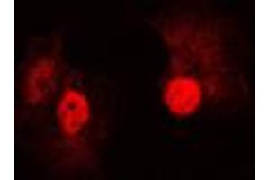 Immunofluorescent analysis of B-RAF staining in A431 cells. (SNRPE 抗体  (Center))