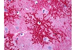 Immunohistochemistry (IHC) image for anti-Solute Carrier Family 1 (Glial High Affinity Glutamate Transporter), Member 2 (SLC1A2) (C-Term) antibody (ABIN960546)