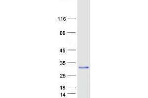 Western Blotting (WB) image for Killer Cell Lectin-Like Receptor Subfamily D, Member 1 (KLRD1) (Transcript Variant 1) protein (Myc-DYKDDDDK Tag) (ABIN2713810)