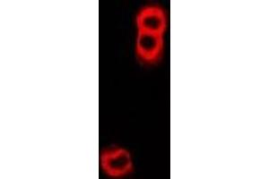 Immunofluorescent analysis of TAP2 staining in U2OS cells. (TAP2 抗体)