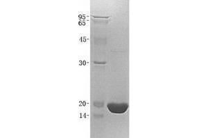 Validation with Western Blot (CST4 Protein (His tag))