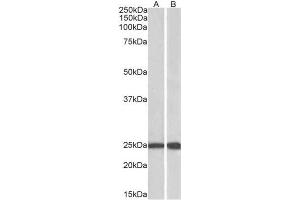 AP23225PU-N RAN antibody staining of Mouse (A) and Rat (B) Testis lysate (35µg protein in RIPA buffer) at 0. (RAN 抗体  (C-Term))