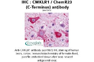 Image no. 1 for anti-Chemokine-Like Receptor 1 (CMKLR1) (C-Term), (Cytoplasmic Domain) antibody (ABIN1733165) (CMKLR1 抗体  (C-Term, Cytoplasmic Domain))