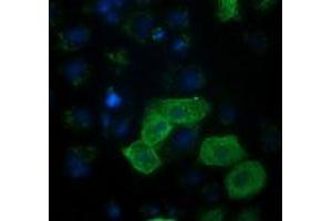 Anti-RASSF1 mouse monoclonal antibody (ABIN2454293) immunofluorescent staining of COS7 cells transiently transfected by pCMV6-ENTRY RASSF1 (RC213525). (RASSF1 抗体)