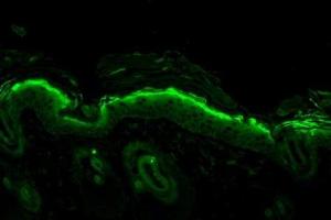 Immunohistochemistry analysis using Mouse Anti-Nitrotyrosine Monoclonal Antibody, Clone 39B6 . (Nitrotyrosine 抗体  (HRP))