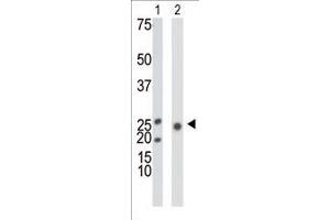 Antibody is used in Western blot to detect KHK in mouse liver tissue lysate (Lane 1) and 293 cell lysate (Lane 2). (Ketohexokinase 抗体  (N-Term))