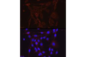 Immunofluorescence analysis of PC-12 cells using SCNN1A Rabbit pAb (ABIN6129465, ABIN6147447, ABIN6147448 and ABIN6221186) at dilution of 1:200 (40x lens). (SCNN1A 抗体  (AA 105-225))