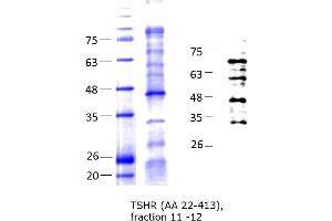 Western Blotting (WB) image for Thyroid Stimulating Hormone Receptor (TSHR) (AA 22-413) protein (His tag) (ABIN3150299)