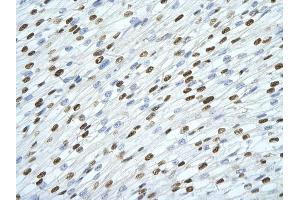 Rabbit Anti-SFPQ antibody         Paraffin Embedded Tissue:  Human Heart    cell Cellular Data:  cardiac cell    Antibody Concentration:  4. (SFPQ 抗体  (Middle Region))