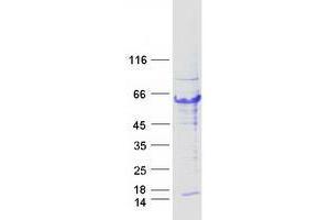 Western Blotting (WB) image for Tripartite Motif Containing 44 (TRIM44) protein (Myc-DYKDDDDK Tag) (ABIN2734270)