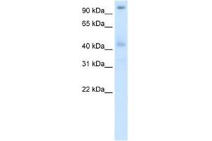 Western Blot showing POGZ antibody used at a concentration of 1-2 ug/ml to detect its target protein. (POGZ 抗体  (N-Term))