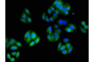 Immunofluorescent analysis of HepG2 cells using ABIN7173663 at dilution of 1:100 and Alexa Fluor 488-congugated AffiniPure Goat Anti-Rabbit IgG(H+L) (TUBA3C 抗体  (AA 161-418))