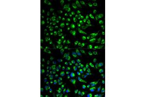 Immunofluorescence analysis of HeLa cell using SPAM1 antibody. (SPAM1 抗体)