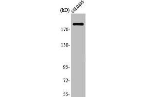 Western Blot analysis of K562 cells using TRAP220 Polyclonal Antibody (MED1 抗体)